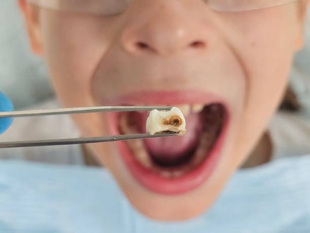 Best Emergency Dentist Open Today  in Schoolcraft, MI